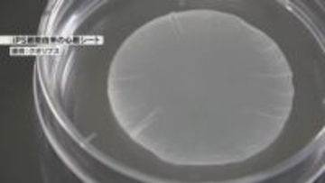 iPS細胞使った心臓病患者のための心筋細胞シート　秋ごろ販売開始へ　大阪大学発のベンチャー企業