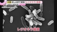 レジオネラ症の患者が増加、過去5年で最多に　水辺に潜む感染菌の危険とは「ぬめりのあるところをきれいに」
