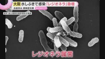レジオネラ症の患者が増加、過去5年で最多に　水辺に潜む感染菌の危険とは「ぬめりのあるところをきれいに」