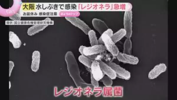 レジオネラ症の患者が増加、過去5年で最多に　水辺に潜む感染菌の危険とは「ぬめりのあるところをきれいに」