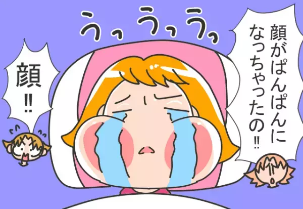 「お母さん、大変！」子どもの顔が…パンパンに腫れてる！？⇒「あのね…」冷蔵庫にあった”まさかのもの”が原因だった…