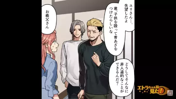 1歳の娘に”暴力”を振るった母親…大きなアザも。だが直後…「誤解です」虐待を疑う世間に”弁明”を試みるが…