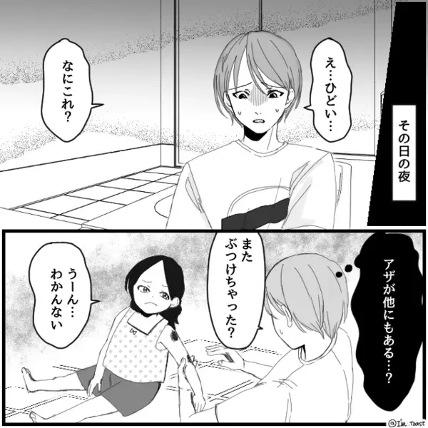 日に日に“アザが増える”娘？医者「お子さんは…」⇒告げられた【診断結果】に妻の血の気が引いたワケ