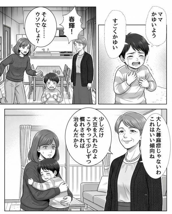 義母の”手料理”で幼い孫が蕁麻疹！？だが後日…義母「大したことないw」医師「お孫さんは…」血の気が引いたワケ