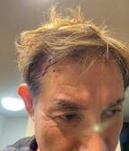 田中健、散歩中に転倒し頭から流血「心配をかけてしまった」
