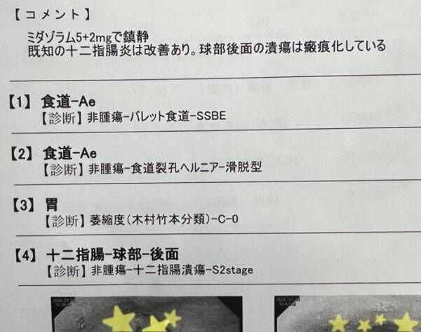 古村比呂、胃カメラ検査の結果を報告「今度の抗がん剤治療まで10日チョッと」