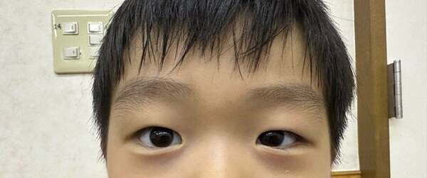 あいのり・桃、息子の目のトラブルで急遽眼科へ「侮れないから本当気をつけて」