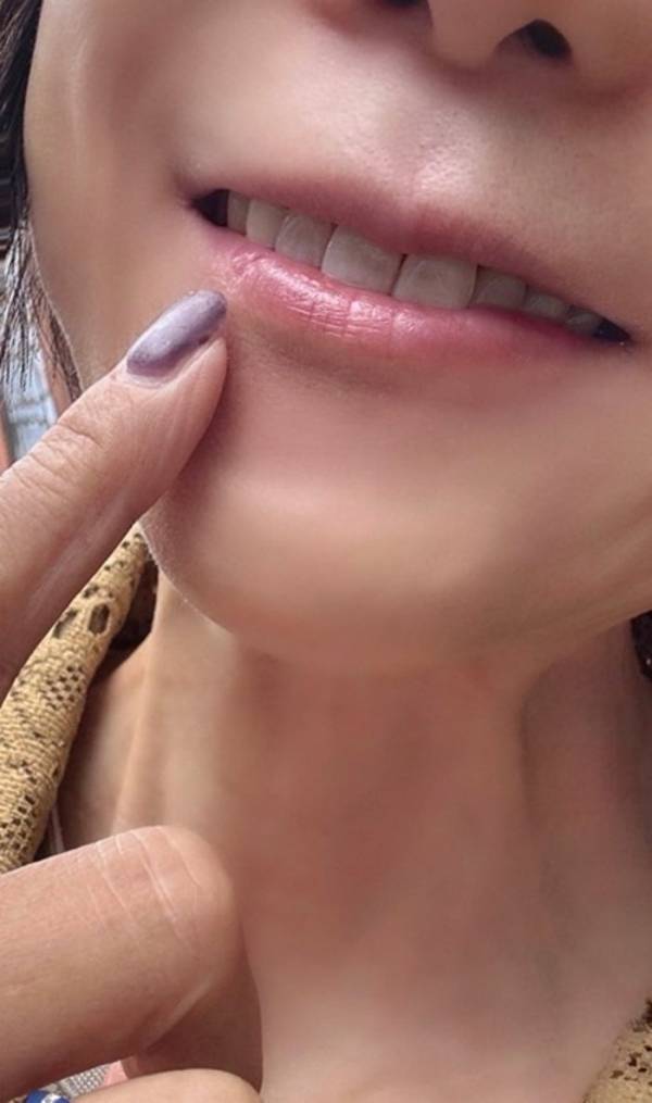 堀ちえみ、ホワイトニング後の歯を公開「自然な白さになって嬉しい」