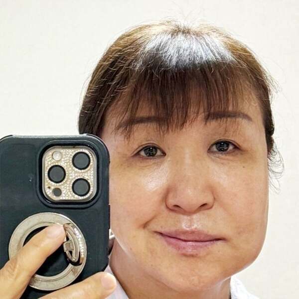 北斗晶「こぶとり爺さんみたい」歯の治療で腫れた顔を公開「笑えました」