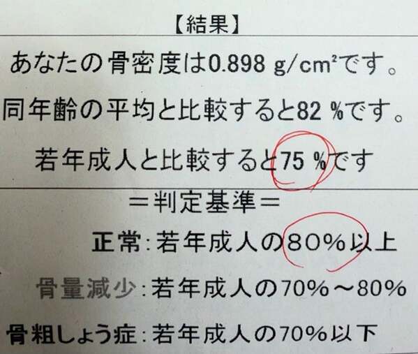 だいたひかる、乳がん治療の影響で骨密度が減少「新しく薬を処方して頂きました」