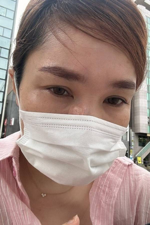 平野ノラ、顔のできものを除去したことを報告「神業で20秒くらい」