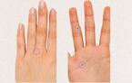 右手薬指のホクロはモテる証！　ホクロや指に潜む意外な「意味」
