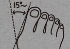 1日各5分の簡単「足裏トレ」で外反母趾&浮き指を防ぐ！