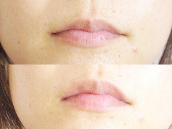 【衝撃】老け顔の原因が唇に!?いますぐできる解消法とは？