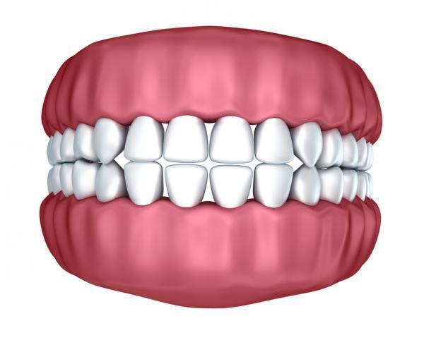 「歯のすきまが気になる…」マツコも受けた、歯茎の移植手術って？