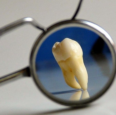 男が思わず釘付けになる！笑顔を100倍かわいく見せる方法とは