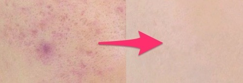 今春大ブーム中！カバー力抜群なのに肌ストレスフリーの万能BB【SNS上の謎の美女MEGBABYも愛用】