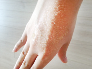 夏のお悩み「かかとのガサガサ」がつるつるに！調味料でつくる簡単レシピ