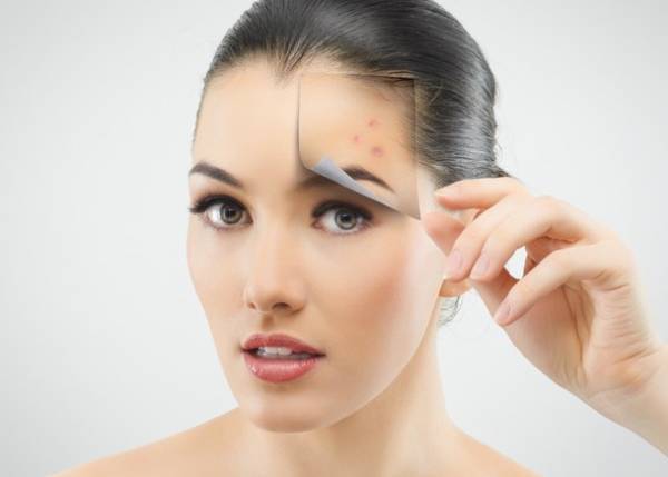 保湿不足が1番NG！繰り返す大人ニキビの正しい予防法とは？