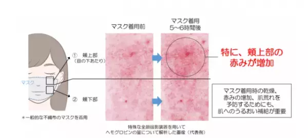 マスクが肌荒れの原因に！？コロナに負けない美肌を作る新ケアとは