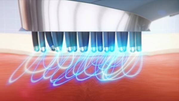 頭皮をほぐして頭も心もすっきり！《新作スカルプケア美容家電3選》