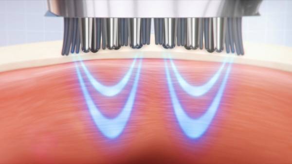 頭皮をほぐして頭も心もすっきり！《新作スカルプケア美容家電3選》