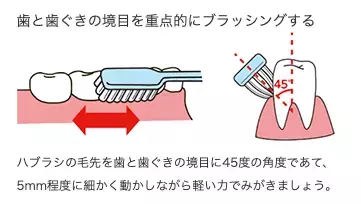 見た目年齢は「歯ぐき」で決まる？美肌の敵「糖化」は口の中でも起こっていた！