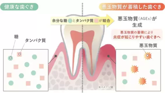 見た目年齢は「歯ぐき」で決まる？美肌の敵「糖化」は口の中でも起こっていた！