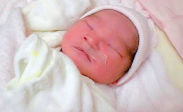 生まれてから口唇口蓋裂と判明。 妊娠中から手術を受けるまで【体験談】