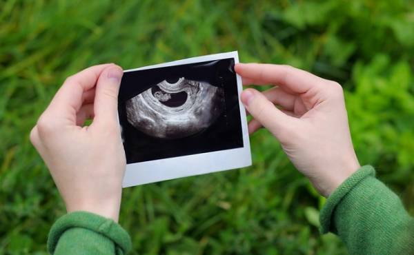 妊婦健診でもらった「超音波写真」どうやってみる？ 何がわかるの？！