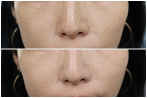 【時短コスメ】下地いらずで速攻美肌になるファンデ＆BBクリーム