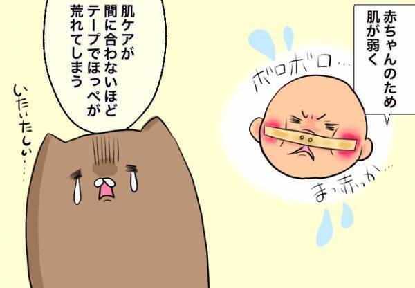 口唇口蓋裂ベビー、想像以上に大変【口唇口蓋裂ちゃん、育ててます41】