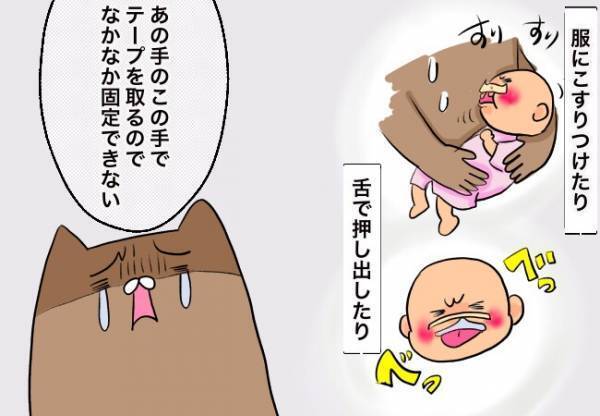 口唇口蓋裂ベビー、想像以上に大変【口唇口蓋裂ちゃん、育ててます41】