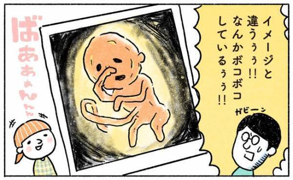 3Dエコー写真の技術に大興奮？【奥さんと子どもに好かれたい！10】