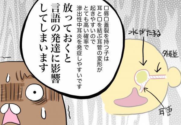 口の障害だけじゃなく耳も難聴？！【口唇口蓋裂ちゃん、育ててます53】
