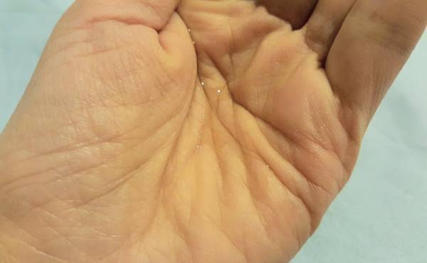 妊娠線予防だけじゃない！ トリロジーのピュアプラントボディオイル