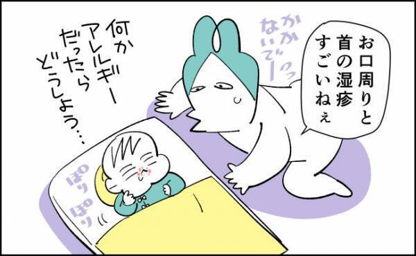 何かのアレルギー？！病院に駆け込むと…【んぎぃちゃんカレンダー91】