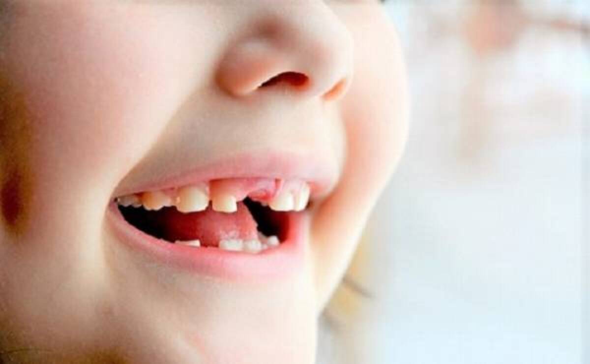 1歳ですべての歯の虫歯と糖尿病を予告された娘 ママの体験談 19年11月15日 ウーマンエキサイト 1 2