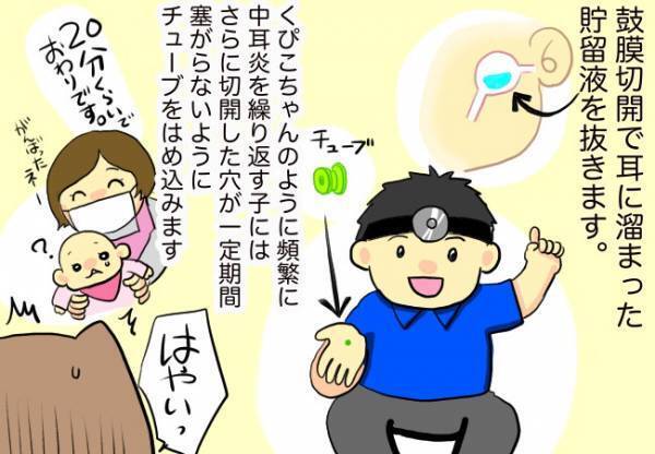 耳にチューブ？急きょ鼓膜切開に【口唇口蓋裂ちゃん、育ててます66】