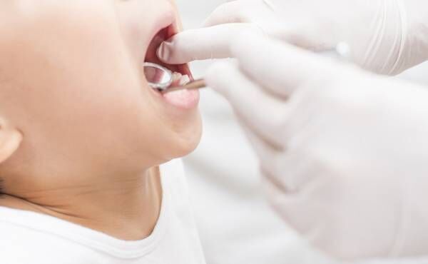 歯並び（受け口）の治療中の子どものイメージ