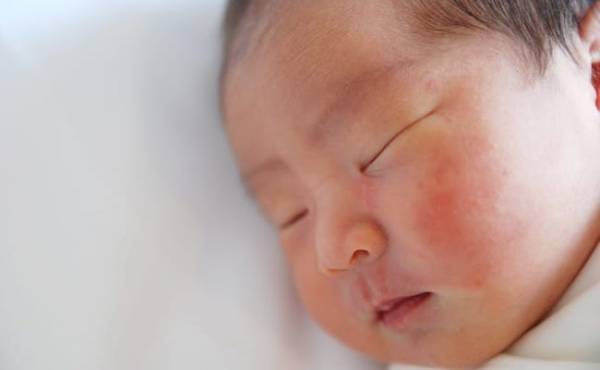 ケアしているのに…。赤ちゃんのスキンケアについて助産師がアドバイス！