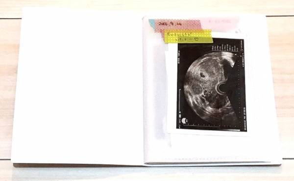 ずぼらな私でもできた！ 簡単・かわいいエコー写真のまとめ方【体験談】