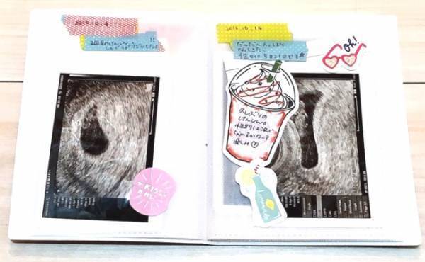 ずぼらな私でもできた！ 簡単・かわいいエコー写真のまとめ方【体験談】