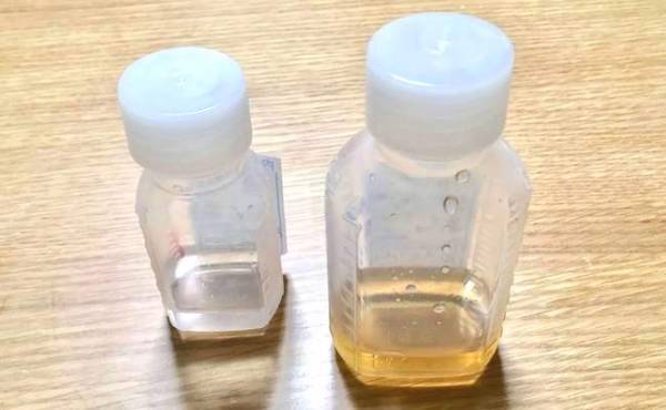 生後6カ月の赤ちゃんが初めて風邪をひいたときのこと【体験談】