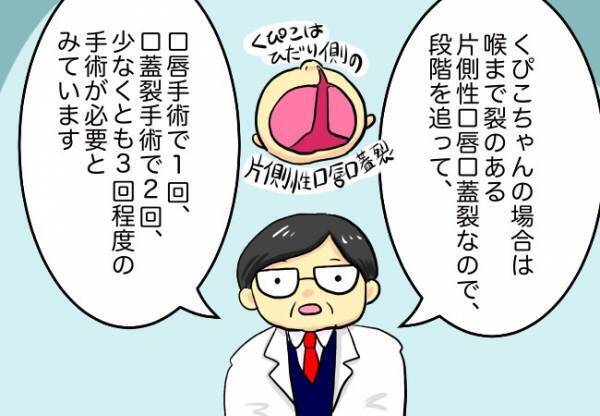 何回手術するかわからないの？【口唇口蓋裂ちゃん、育ててます32】 #べビカレ春のマンガ祭り