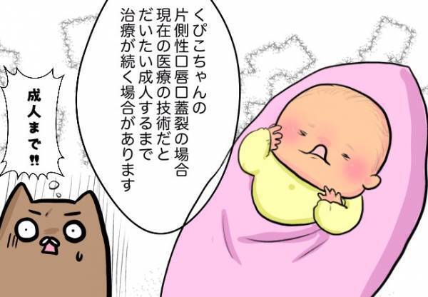 口唇口蓋裂の治療、いつまで続くの？【口唇口蓋裂ちゃん、育ててます33】 #べビカレ春のマンガ祭り
