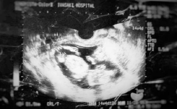 驚きの出生体重！ 生まれた赤ちゃんは超ビッグだった【出産体験談】