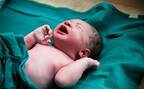 【お産の緊急処置】鉗子分娩になるときって？ 鉗子分娩の方法とリスク