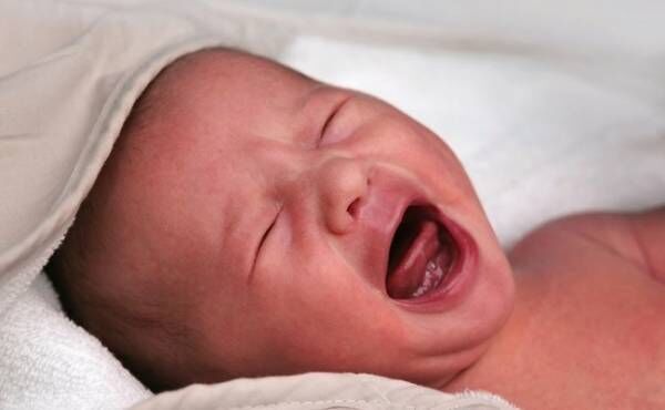 お産の緊急処置 吸引分娩になるときって 吸引分娩の方法とリスク 19年5月7日 ウーマンエキサイト 1 2