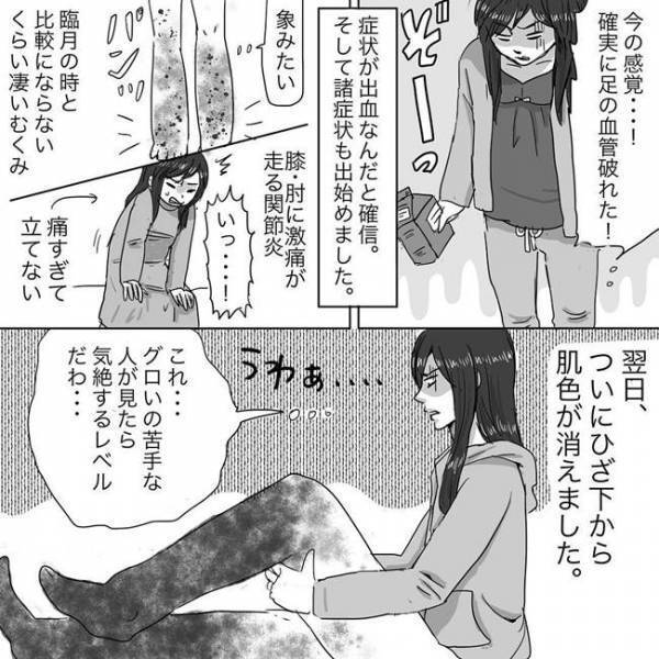 産後無理したせい？聞いたことない病名告知に「え？」ニシカタ体験談28